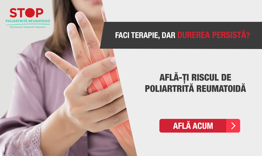 artrita reumatoida la 20 de ani