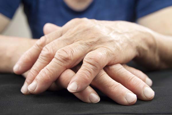 poate fi vindecată artrita reumatoidă tratamentul articulațiilor bolnave ale mâinilor