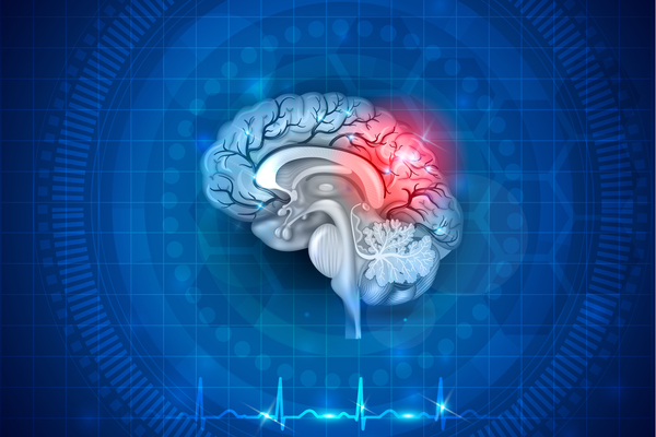 Reintegrare in societate dupa un infarct miocardic sau AVC